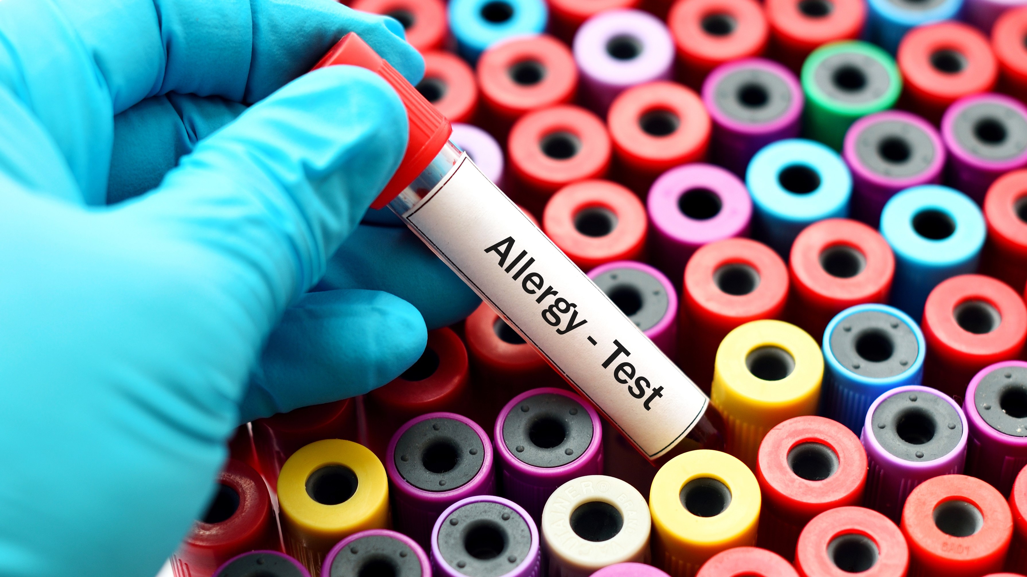 Teströhrchen für Allergietests