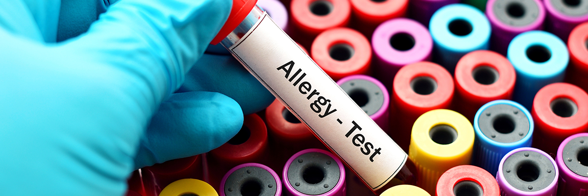 Teströhrchen mit dem Schriftzug: Allergy - Test